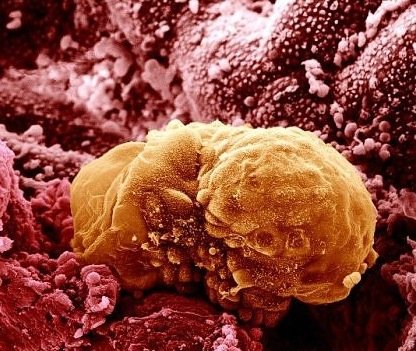 Six-day-old human embryo