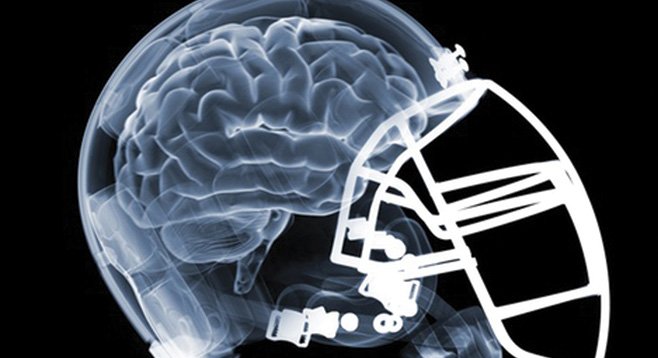 News studies note the similarity between sports and military brain trauma.