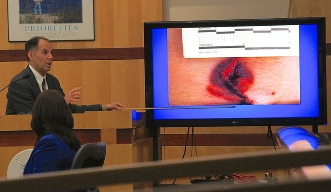 Dr. Campman explained the "contact wound" to the jury. Photo Eva.