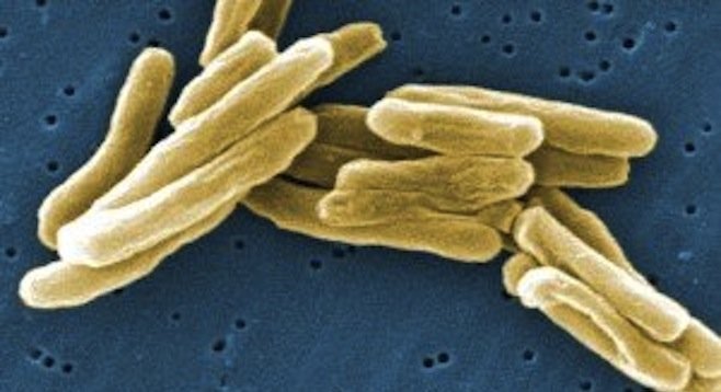Bacterium that causes tuberculosis (CDC photo)