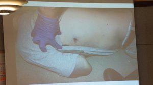 Evidence photo of victim's bullet wound, presented at preliminary hearing in December of 2012.