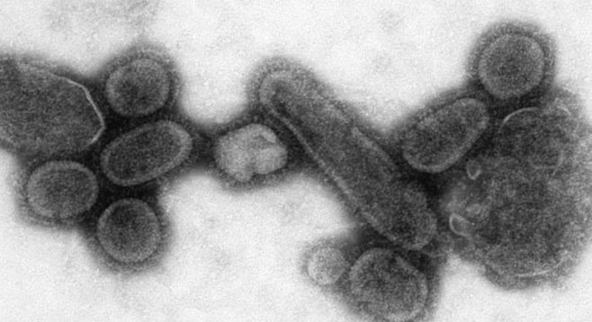 Microscopic image of a flu virus