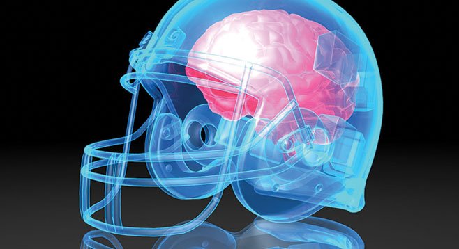 These brain-concussion lawsuits will stretch on until somebody invents brain-replacement surgery.