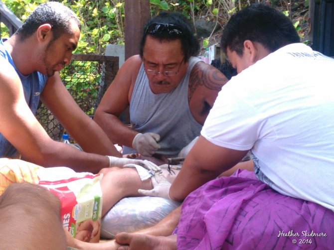 Traditional Samoan Tattoo at Tisa's Barefoot Bar. 
American Samoa