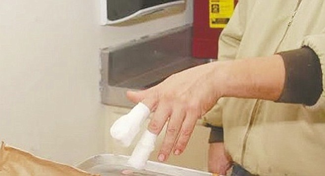 Robbery victim's injured hand