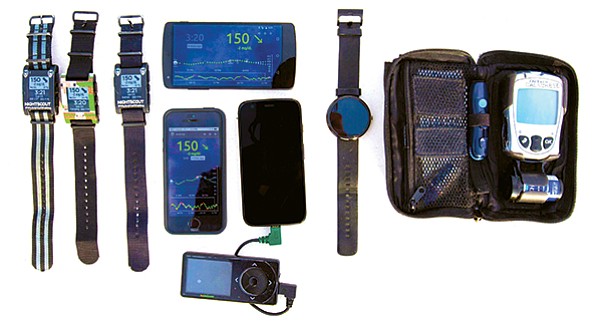 Nightscout and other gadgets used by the Calabrese family