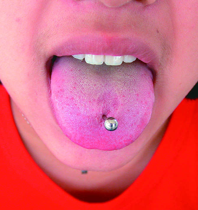You can always change your mind about a tongue piercing. Once the jewelry is removed, the hole closes up in 48 hours.
