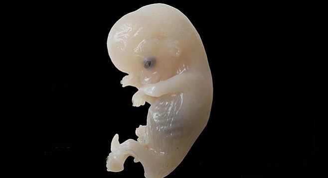 Human embryo, 8–9 weeks