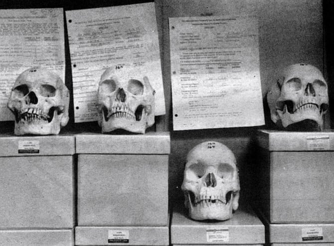 Skulls for check-out at Learning Resource Center. The classes of 1982 and 1983 caused a stir among the UCSD School of Medicine faculty when as a group they scored poorly on the national board examinations.