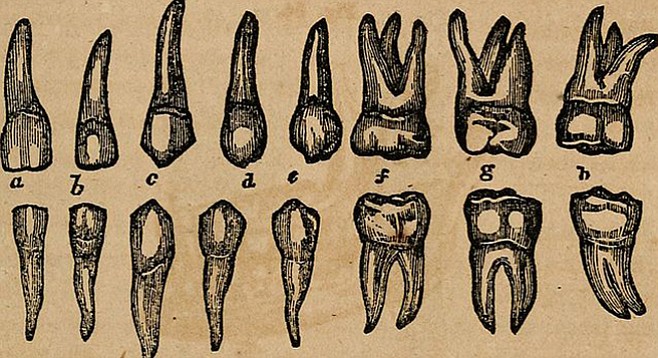 Vintage teeth, because anything else would be too horrible.