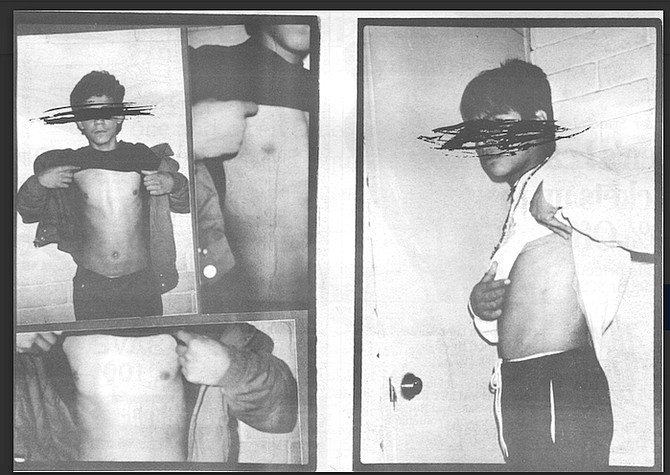 Most of the torture methods used by the police, however, leave little physical evidence. 