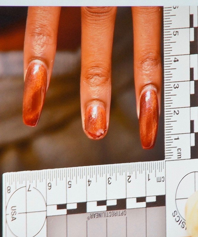 Photo of Chevis' hand when she was arrested. 