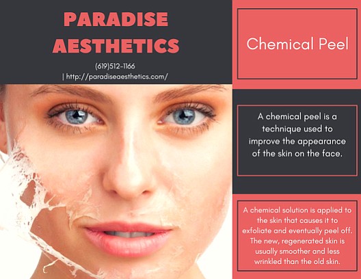 Call paradise Aesthetics for your appointment (619)512-1166