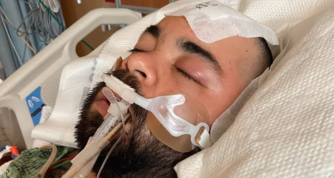 Anthony Bejaran was in a coma for over a week after being attacked at Tremont and Pier View Way.