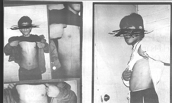 Most of the torture methods used by the police, however, leave little physical evidence.