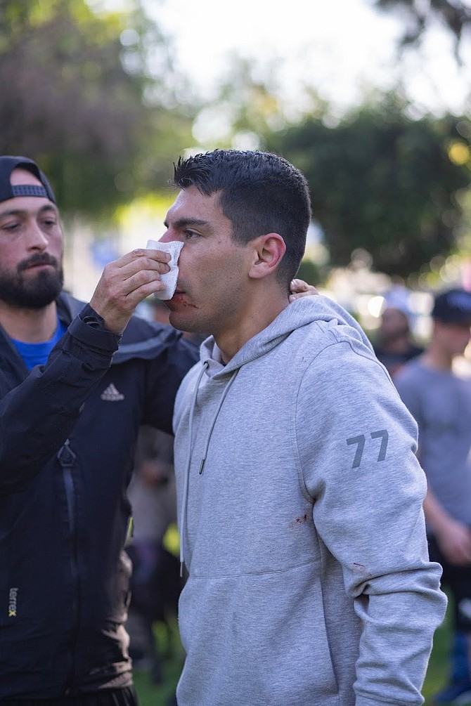 With a bloodied nose and a fat lip, Tito accepted his defeat.
