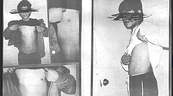 Most of the torture methods used by the police, however, leave little physical evidence.