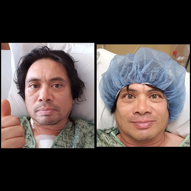 Anthony Arellano underwent an 8 hour open-heart surgery - Image by Courtesy Mishey Touchie
